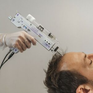 traitement anti-chute de cheveux
