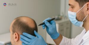 coût d’une greffe de cheveux France