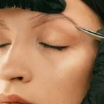 greffe de sourcils | NY Center