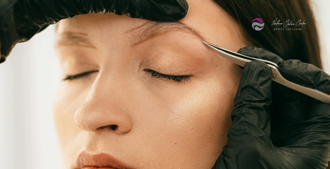 greffe de sourcils | NY Center