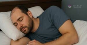 comment dormir après une greffe de cheveux