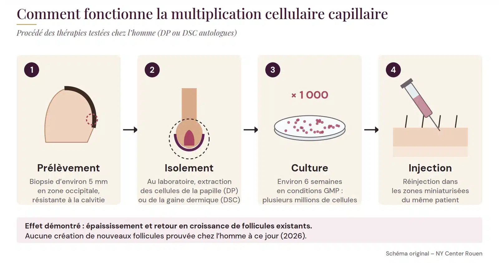Étapes de la multiplication cellulaire capillaire : prélèvement, isolement, culture puis injection