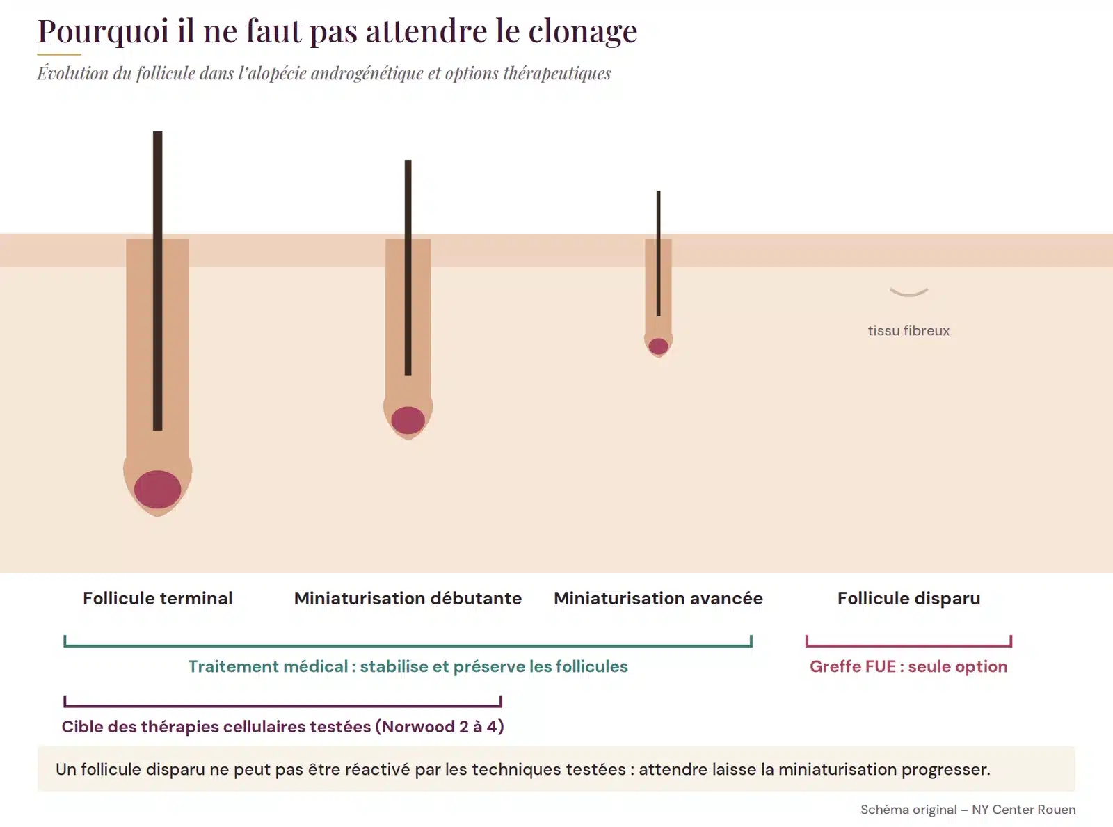 Évolution du follicule dans l’alopécie androgénétique et fenêtre d’efficacité des traitements