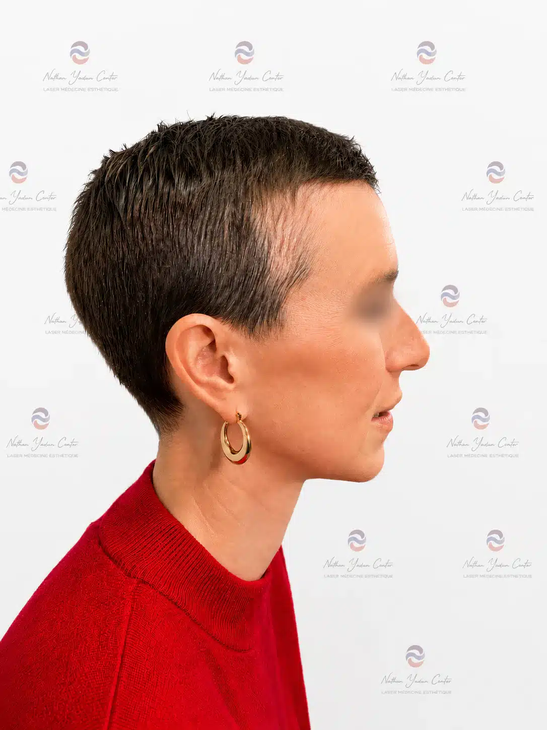 Avant la greffe — Greffe femme, femme, 41 ans