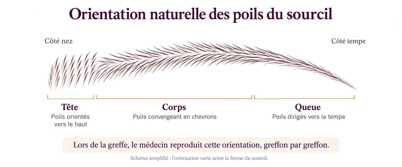 Orientation naturelle des poils du sourcil : dans la tête, côté nez, poils orientés vers le haut ; dans le corps, poils convergeant en chevrons ; dans la queue, poils dirigés vers la tempe. Lors de la greffe, le médecin reproduit cette orientation, greffon par greffon.